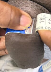 Sétimo dia com 14,5 cm. Liberado para manter relações.